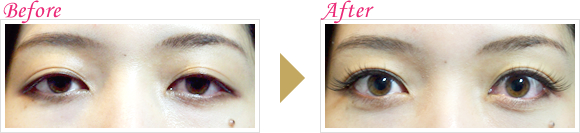 まつ毛エクステンションのビフォーアフター